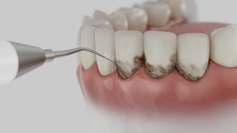 Reliable Dental contractor in Wheatland, CA by Smile Center Dentistry